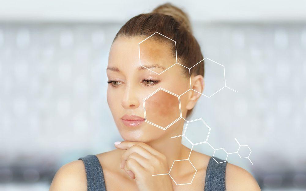Retinol trị nám tàn nhang có hiệu quả không? Giải mã công dụng từ A-Z