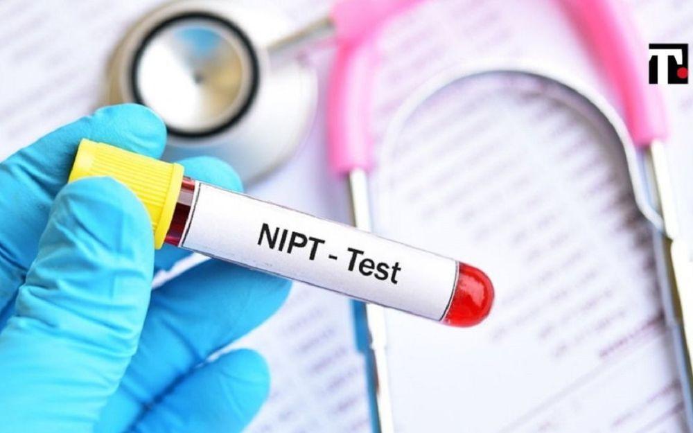  Cách đọc kết quả xét nghiệm NIPT đúng cách mẹ bầu cần biết